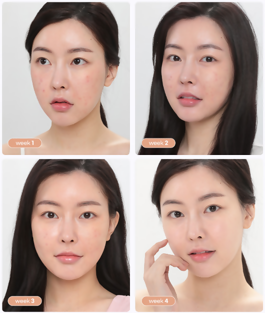 [CRAZY SKIN]미친스킨 미친 수면크림 UPGRADE(슬리핑팩) _Skin Repair Trouble Care Sleeping Cream_night mask recovery care
