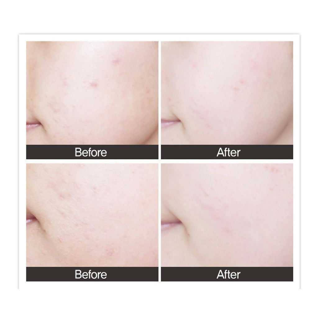 [CRAZY SKIN]미친스킨 센텔라티카 앰플 100ml