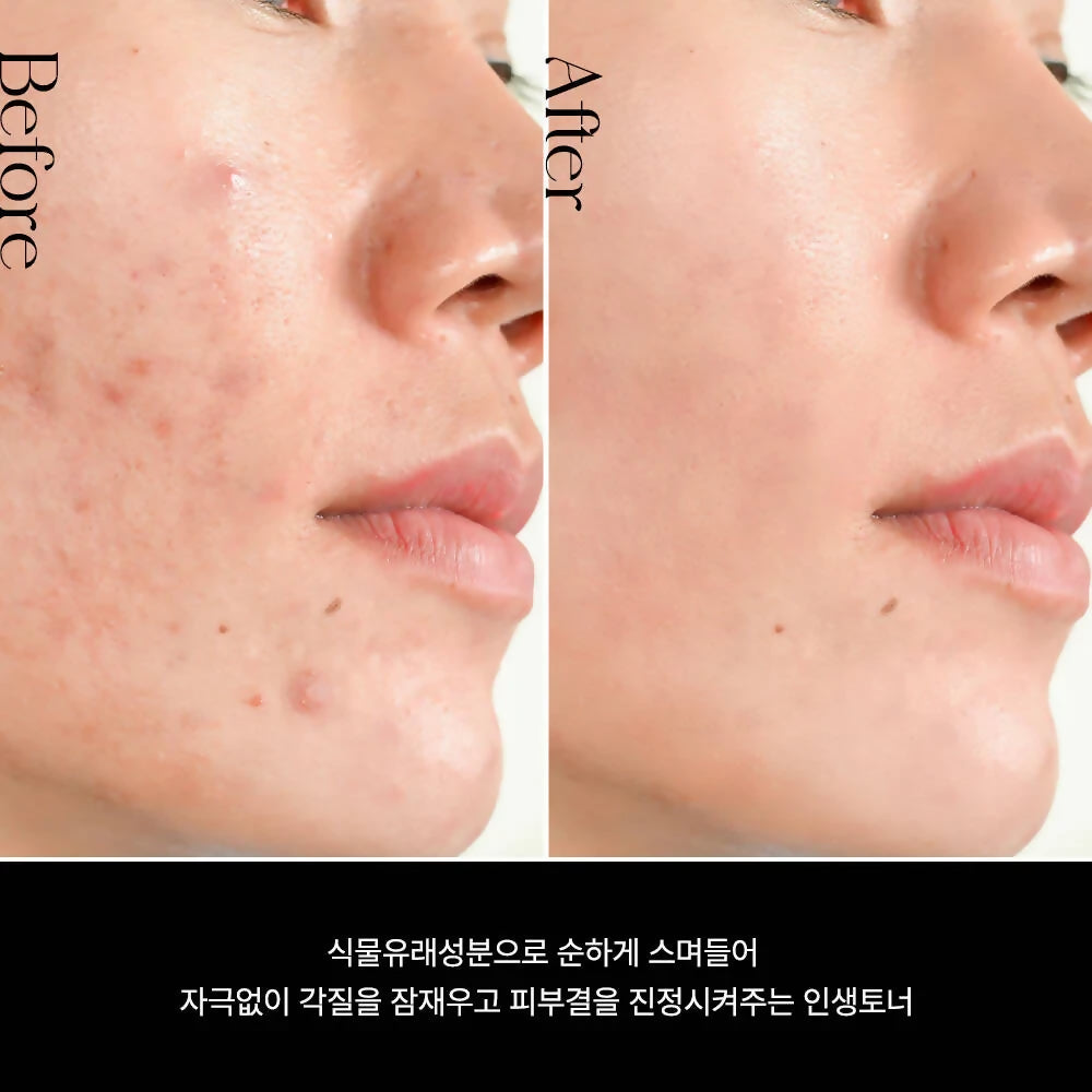 [SON&PARK] 손앤박 뷰티워터 토너 Beauty Water 340ml + 여행용 60ml + 비건 핸드 밤 크림 50ml (BLOSSOM HILL) 세트